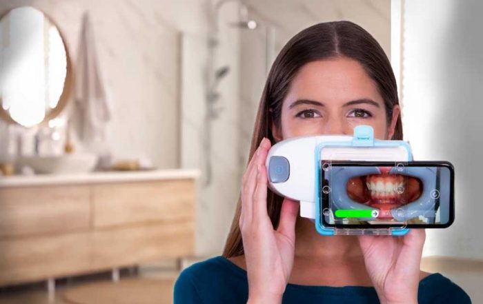 Invisalign patient scanning her smile for her orthodontist feedback.